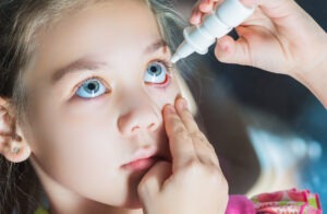 dry eye in children