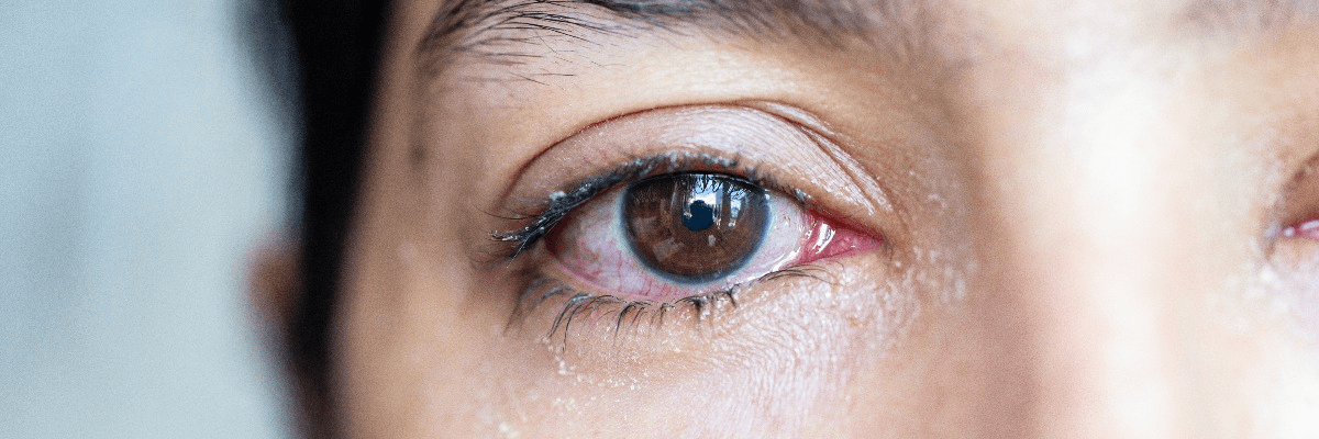 Close up shot of woman's eye watering
